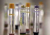 Novo Nordisk 4 of 5